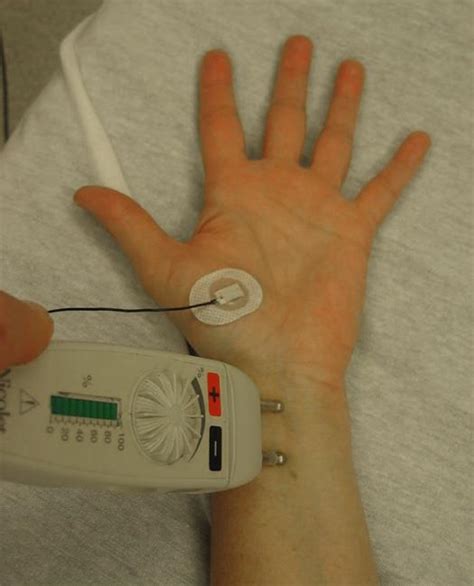 Emg Nerve Conduction Test Painful Connectionsetp