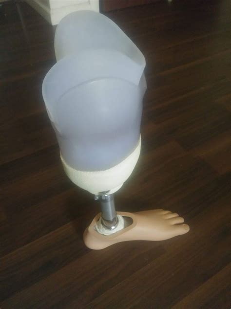 Titanium To The Knee Prosthetic Leg With Suction Top Just Below Knee
