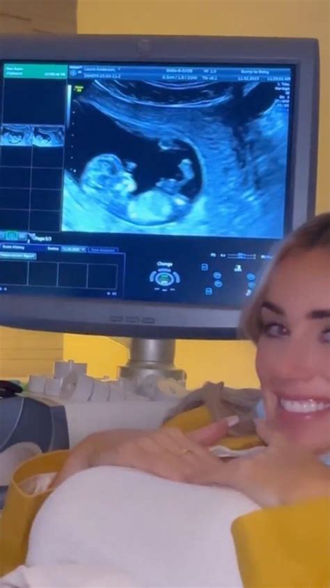 Laura Anderson Pregnant With First Baby With Boyfriend Gary Lucy