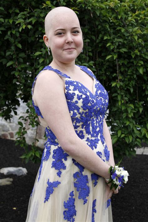Battling Cancer Garden Spot Teen Amber Martin Is Set To