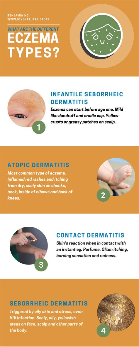 7 Types Of Eczema