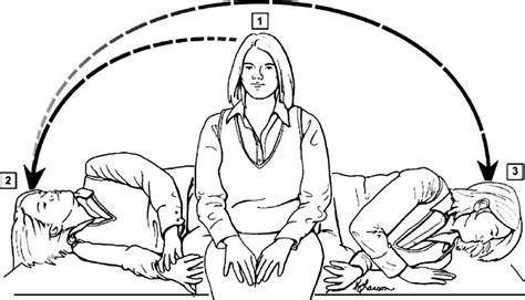 Epley Manöver Rechts Pdf Handout Visualizing The Epley Maneuver In