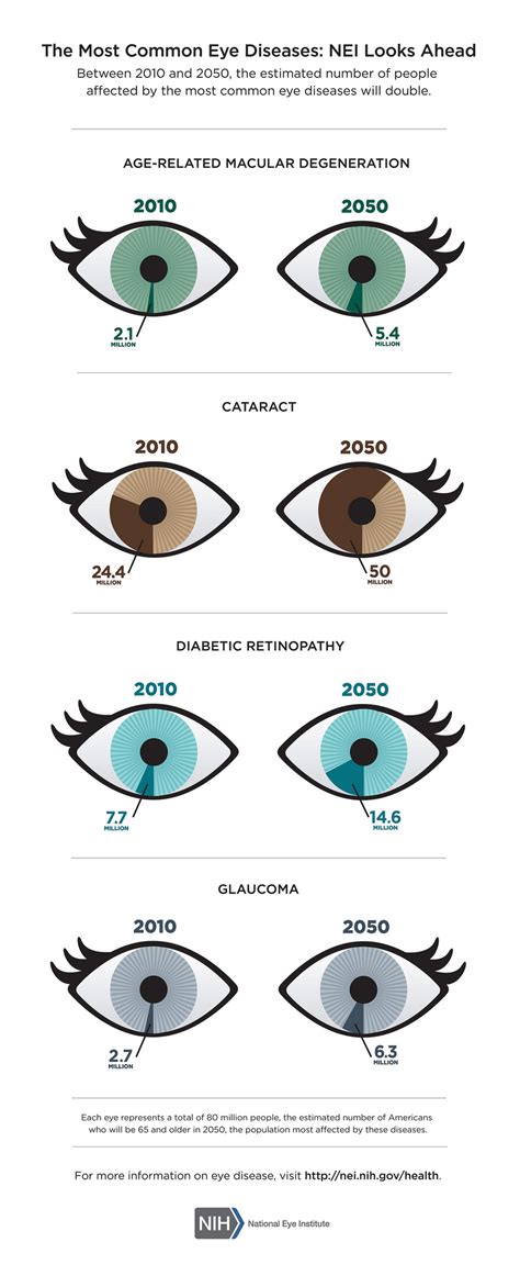 Common Eye Disease By Nih 111015 Discovery Eye Foundation