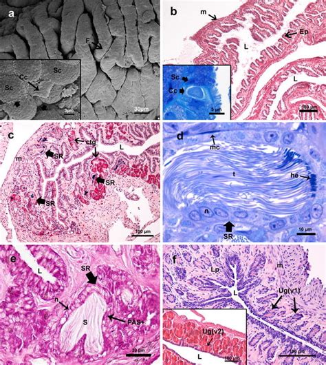 Photomicrograph Of The Infundibulum And Uterus Of P Patagoniensisa