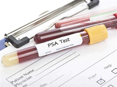 Teste De Psa Antígeno Prostático Específico Valores Para Que Serve