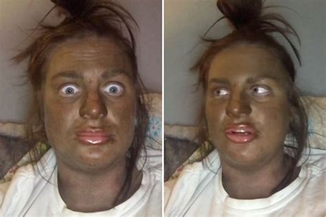 Woman Fears Worst Fake Tan Fail Ever After Piling On Layers Of St