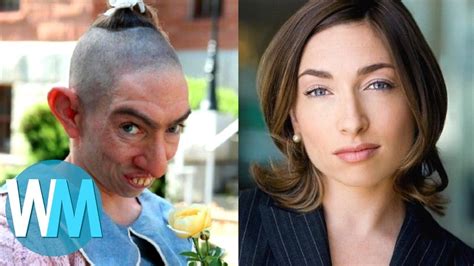 Actresses Who Became Ugly