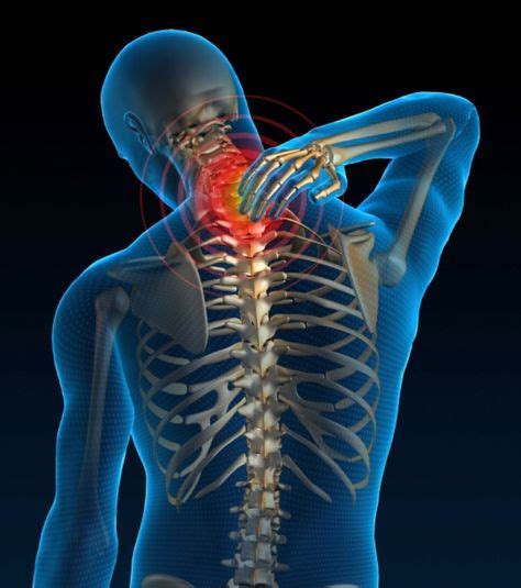 Cervical Sprain An Injury To The Ligament Sprain Or Muscle Strain