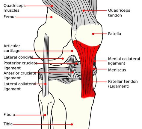 Patellar Tendonitis Jumpers Knee Causes Treatment And Prevention