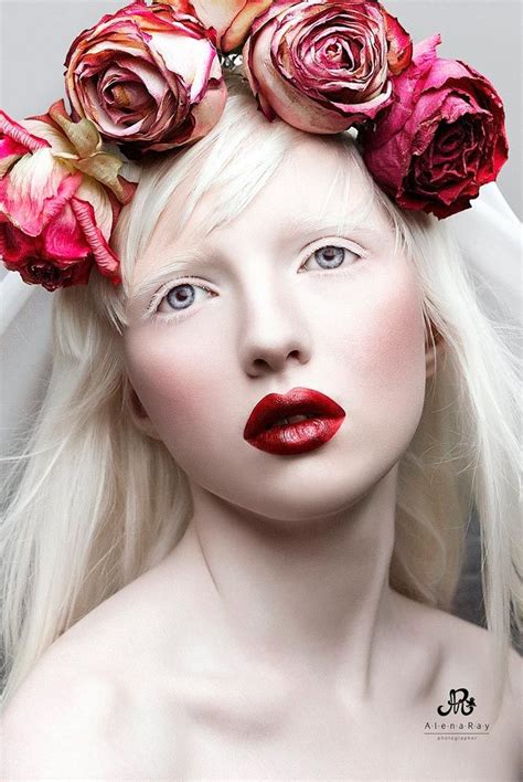 Meet The Most Beautiful Albino Girl In The World