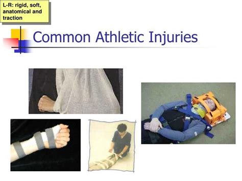 Ppt Care Prevention And Rehabilitation Of Sports Injuries Common