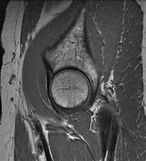 Mri anatomy and positioning series module 2: MRI of the Lower Extremities | Radiology Key