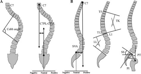 Measurements Of Coronal A And Sagittal B Spinal Alignment