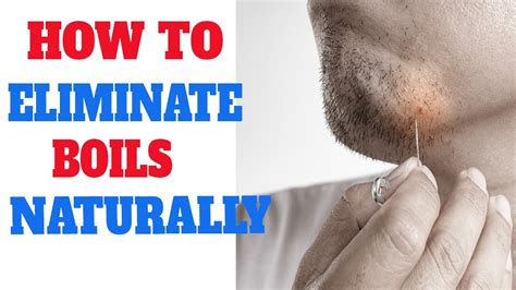 7 Quick Natural Ways To Get Rid Of Boils On Skin How To Treat Boils