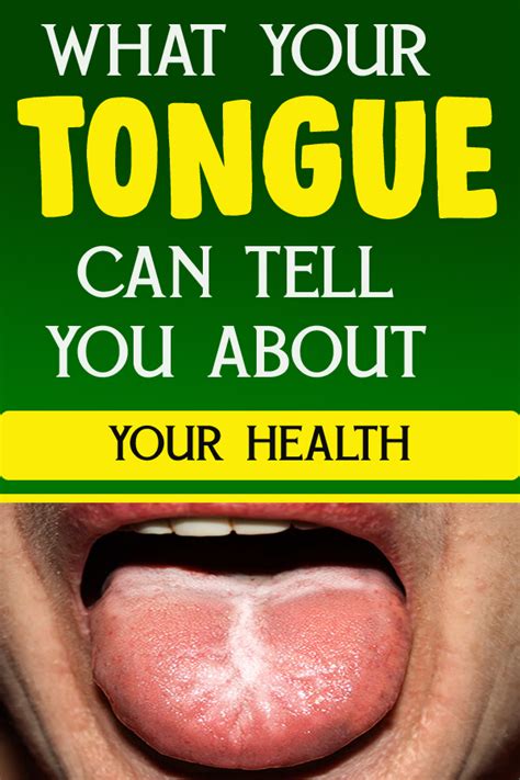 what your tongue can tell you about your health
