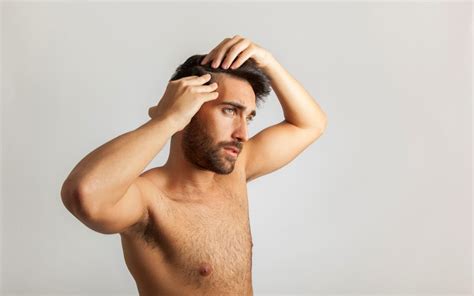 Perte De Cheveux Comment Différencier Calvitie Et Pelade Maison