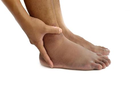 What Is Foot Cellulitis With Pictures