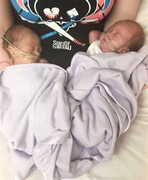 Mother Who Expected Stillbirth Gives Birth To Two Healthy Babies Photos