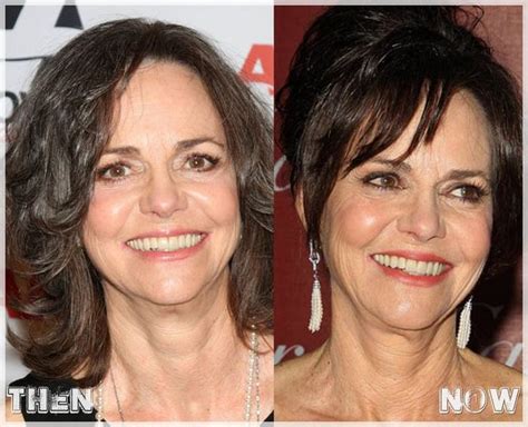 Sally Field Plastic Surgery Young At 70 Informatives She Is An