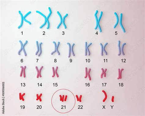 Down Syndrome Karyotype Male Labeled Trisomy 21 3d Illustration Stock 일러스트레이션 Adobe Stock