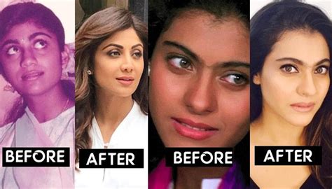 Dusky Bollywood Divas Who Went For Skin Lightening Treatment