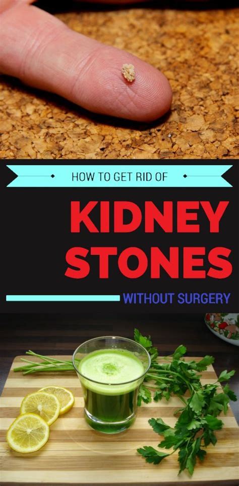How To Get Rid Of Kidney Stones Without Surgery Healthy Lifestyle