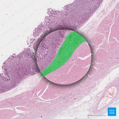 Stomach Histology Mucosa Glands And Layers Kenhub Sexiz Pix