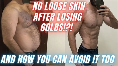 How To Avoid Loose Skin After Weight Loss Prevent Excess Skin After