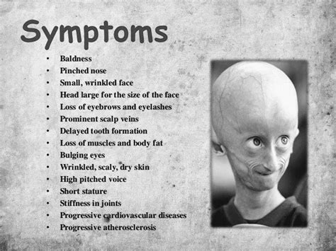 What Is Progeria Pt Master Guide