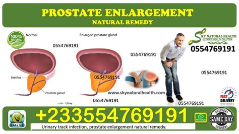 Prostate Enlargement Remedy In Ghana Sky Natural Health