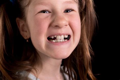 478 Kid Crooked Teeth Stock Photos Free And Royalty Free Stock Photos