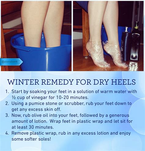 19 Fresh Toenails Look Dry Dry Heels Keep Your Feet Soft And Hydrated