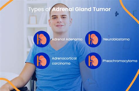Adrenal Gland Tumor Everything You Need To Know Actc