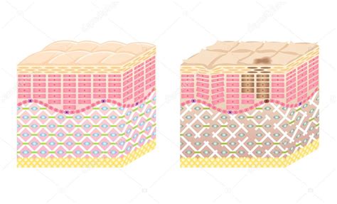 Skin Cross Section Stock Vector Image By ©lalan33 3971418