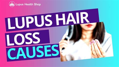 Causes Of Lupus Hair Loss Lupus Life Hacks® Lupus Health Shop Youtube