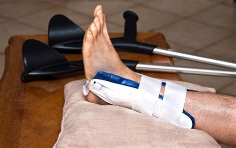 Fracture Ankle Treatment Singapore Sports Clinic