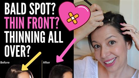 Hiding Thinning Hair On Top For Females Hairstyle Tips For Bald Spots Thin Fronts And Parts