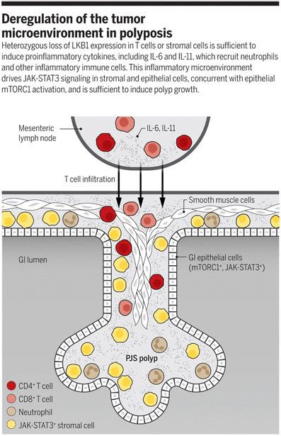 Inflamed T Cells And Stroma Drive Gut Tumors Science