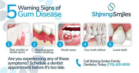 How To Spot The Early Signs Of Gum Disease Shining Smiles Family Dentistry