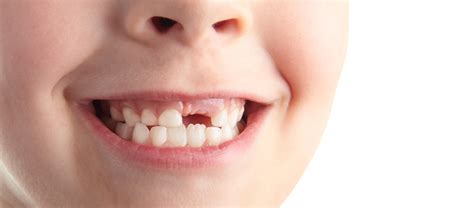 Loose Baby Tooth Top Tips From The Pros Toothstars