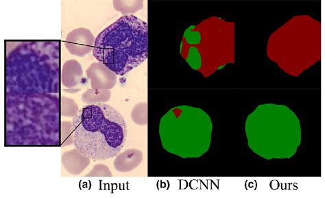 Some Images Of Basophil Granulocyte Ba And Band Neutrophil Bne