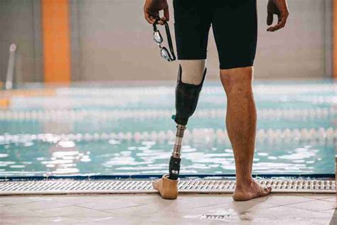 the need for prosthetics why people require them worldprosthetic