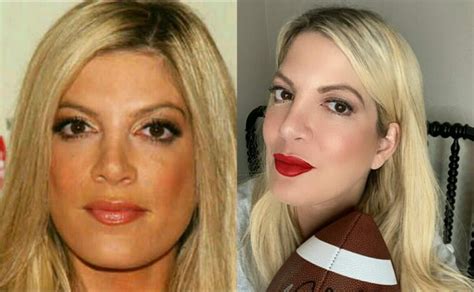 Before And After Pics Of Hollywood Celebrities Having Plastic