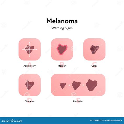 Melanoma Cancer Anatomical Infographic Poster Vector Flat Medical