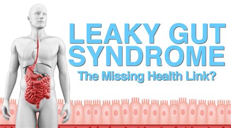 Leaky Gut Syndrome The Missing Health Link Vitality And Wellness