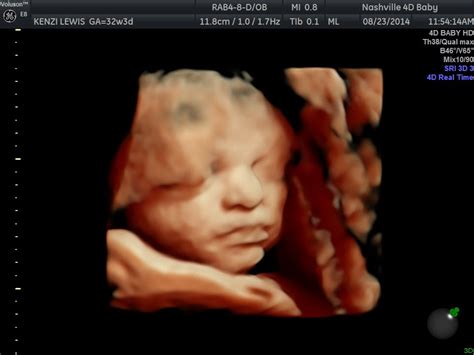 3d4d Ultrasound Hd Live 32 Weeks Youtube