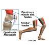 The proper height is extremely could this be made for a tripped? Quadriceps Tendonitis | eOrthopod.com