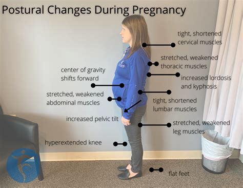 Postural Changes In Pregnancy Womens Health