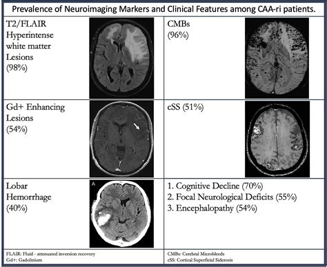 Clinical Neuroimaging And Genetic Markers In Cerebral Amyloid