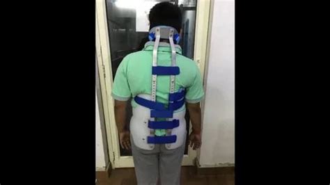 Boston Brace For Scoliosis At Rs 13999piece Upper Limb Orthotic In